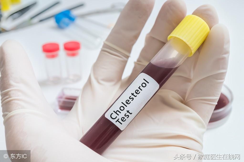 糖尿病的成因，深度解析其背后的原因，深度解析糖尿病成因，揭示背后原因真相