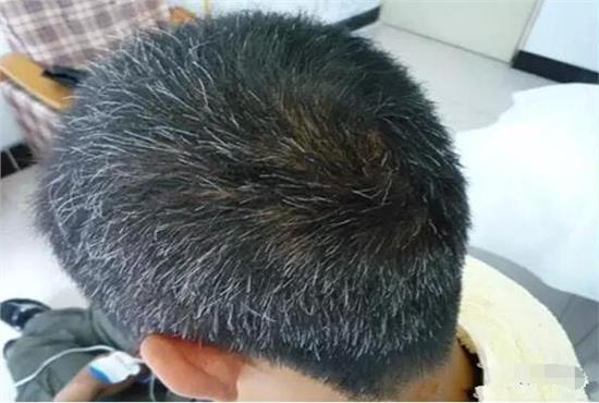 白發(fā)變黑發(fā)最好的土方法——自然黑發(fā)秘訣，自然黑發(fā)秘訣，白發(fā)變黑的土方法