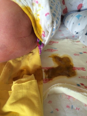 新生兒吃母乳拉稀黃水，原因、應(yīng)對措施與關(guān)注重點，新生兒母乳喂養(yǎng)后拉稀黃水，原因、應(yīng)對方法與關(guān)注重點