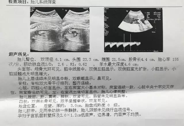 殲-11B重型戰(zhàn)斗機(jī)，卓越性能與先進(jìn)技術(shù)的完美結(jié)合，殲-11B重型戰(zhàn)斗機(jī)，卓越性能與技術(shù)的巔峰融合
