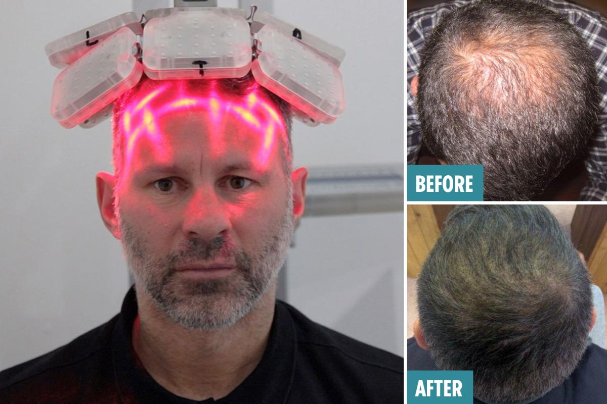 激光手術(shù)費(fèi)用詳解，多少錢一次？，激光手術(shù)費(fèi)用全面解析，手術(shù)費(fèi)用究竟是多少？