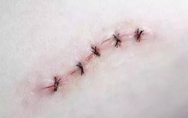 皮膚擦破皮了最快恢復(fù)方法不留疤——專(zhuān)業(yè)指南與實(shí)用建議，皮膚擦傷快速恢復(fù)不留疤，專(zhuān)業(yè)指南與實(shí)用建議