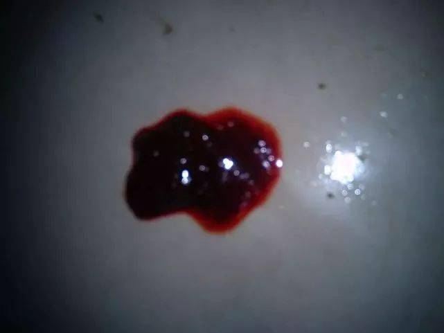 排便時(shí)出現(xiàn)撕裂感及出血，原因與應(yīng)對(duì)措施，排便疼痛撕裂感及出血，原因分析及應(yīng)對(duì)方法