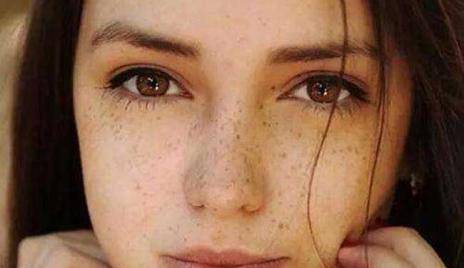 如何淡化臉上的斑，多種方法助你擁有無(wú)瑕肌膚，多種方法助你淡化臉部斑點(diǎn)，重塑無(wú)瑕肌膚